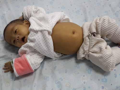 ҽԺ˵��ʱ�����µ�����̫С�ˣ���Ȼ�Ѿ������˸������˺͸θ�ˮ������Ҫ�ٵȺ��Ӵ�Щ����������ֲ�������ְ�����ֻ���ٴν�С������ϼң�һֱ�����������˸��µ�ʱ�򣬲��ٴδ���̤����ҽ�ĵ�·����һ�εı������Ѿ����ص�������������ֲ�����ͻ�������Σ�յĳ̶��ˣ��ɰ���������ʱ��������������