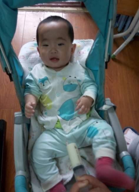 ���ӷ��׺�ת���Ժ�ص��ϼң�����θ�������Ӫ����ͨ������ע��Ӫ����ά�֡�����΢ƽ�ɾͻ�Ǻ�̣�һǺ���ֻ����������Է��ס�2016��4��12��Ϊ���ף������ٴ�סԺ����Ϊʳ����խ���������ж�ͯҽԺ�����ٴν���������Ȼ����Ϣ�ٴδ����������ڶ��ε�����Ҳû�гɹ�����������ֻ���4���Ԫ��