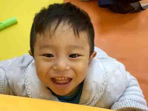 С���Ǹ����۾��Ŀɰ�����������һֱϤ���������������о�����Ƥ�����ƣ���ҽԺȥ��飬ҽ����������������ͳ����˻Ƶ�ҩ�����Ƕ�û��Ч��������������˺����е�ҽԺ��飬Ҳû�н�������ڱ��������µ�ʱ��ͻ�����գ����Բ��ȣ���ɰ������Ż��ˣ���æ����С����϶�ͯҽԺ������