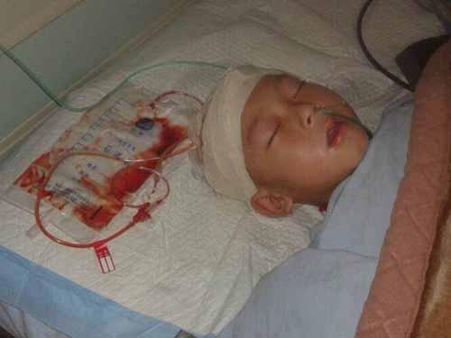 ʮ���ĺ��������յ�����������ج�ģ�����������ұ�һ��Ħ�г�ײ�����ˣ���������δ���굥�����裬����Ҳ�Ƿǳ����ѣ��߾�����Ҳֻ���⳥����ҽҩ�ѣ�Ϊ����Ⱥ��ӵ�����ֻ���Լ���취�������������ѻ���ʮ������࣬�������ο�­������һ����ֲ�������������ֱ�ȷ��Ϊ­�ڸ�Ⱦ��