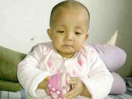 ��ҽ�����˺��ӵĲ��飬����ĸ�ĸ�ڱ��˹���ѡ�����������侲������֪����������ôС����Ҫ��ĸ���չˣ�2015��3�£���������������ҽԺ�������˸�������������һ����������������ı�������״̬�ܺã�һ���˶��ܸ��ˣ�����Ϊ������һ�����ˣ�����2015��ף�С�����Ƥ���ֱ���ˡ�