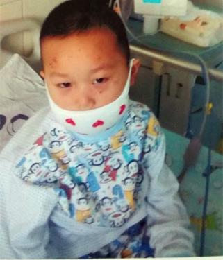 ������������Ѫ��һ������7�춼û��Ч�������ּ��ˣ�ҽ��˵�Ǿ������ưɣ�������������һ·�����ְѺ���ת�ع����и��ױ���Ժ������Ҳ�Ӹտ�ʼ�ĸ�Σ���������ظ�Σ����������ôһ�λ���Ӳ�������ӳ���72�죬�������嵹����������;Ҳ�и�Ⱦ