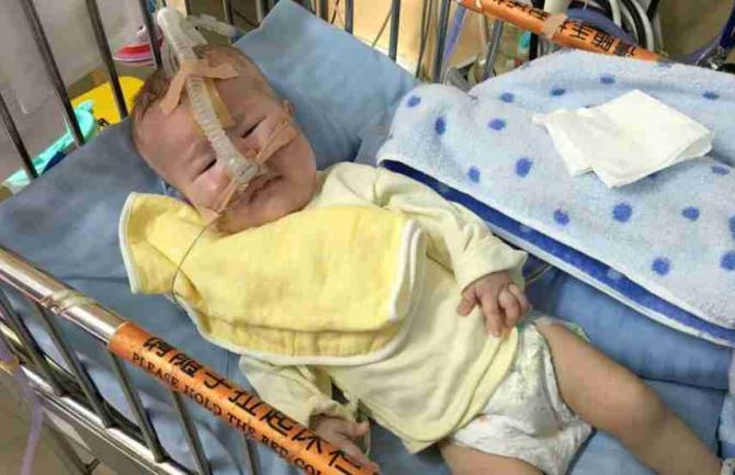 ���ȵ�ʱ��2���µ�С����������۾��ڿ��Űְ����裬��������ʹ�ĵ��ڸ��2��12�գ���С���������أ����ò���������ͻ���ICU�������ȡ����캢�ӵ������ر�죬�����ǳ������������һֱ������ȥ����˥������Ҫ�Ϻ����������ܿ����Ժ���������ò�����Ϊ�˱�ס���ӵ������������ǩ���֡�