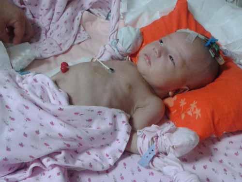 ���ڵ���ҽ�Ƽ������ޣ�ҽ��˵��˼���Ĳ���Ҫת�����õ�ҽԺ�������ơ����ǣ���ĸ����˼��շת�����˱�����������һ���������,10��21�գ�˼�������˸��ͻ��ԣ�ҽ�����Ϊ��ճ��������������Ϊ˼�����˳�ճ���ɽ�����������������֢�໤�ҽ�����1���µ����ƣ�����ת����ͨ������