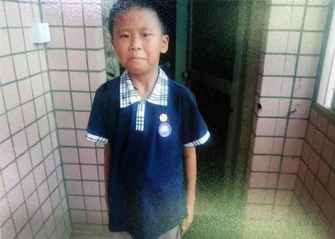 �������ţ����������������ţ����ӻ�ָ������ġ��ɲ��ҵ����鷢���ˣ���5��4����Ϊ͸���ĸ�Ⱦ����ʹ����־�����ٴ�ס����ҽԺ��������ʮ��������ƣ�־�µ������΢�к�ת�ˣ����ǲ�ʹ����ĥ���������ܵĺ��ӣ���������Ҳ�����ᡣ��������������׵����ƣ����ӵĲ�����������ȥ�ˡ�