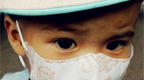 �������Ϻ��»�ҽԺ������9���Ƴ̵Ļ��ơ������ڼ侭���������θ��ո�Ⱦ��ѪС���ε���10���¡�С����һ�δζ�ͦ�����ˣ�ҽԺΪ�������˸������Ƶļ�飬���Ϊ��1���ʸ�ϸ����֯ϸ������֢��2���̷�����Ѫϸ���ۺ�֢��3����Ӳ����