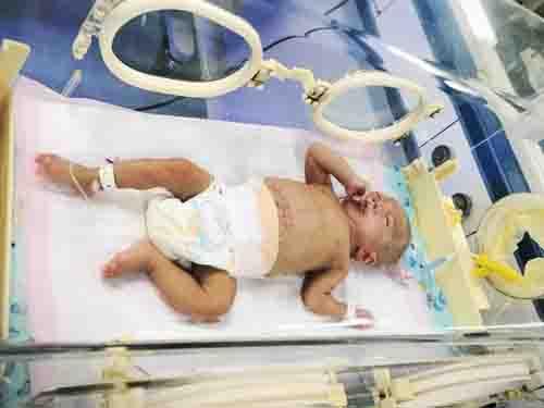 ��δ��ϲ�������ѣ������漴��ת����֢�໤�ң���������Թ�Ӥ�����������������״����Ŀǰ������Σ�ա�ҽ���Ļ���ȫ���˵��Ķ����������Ž������������Լ��������������������Ҫ�򶨣���Ҫ��ο�����ĸ�ĸ����Ҫ�չ˲��������ּ��������İ��ˡ������Ž����ϻ��ϼ������ݽ���5���Ǯ����סԺ�ѡ�