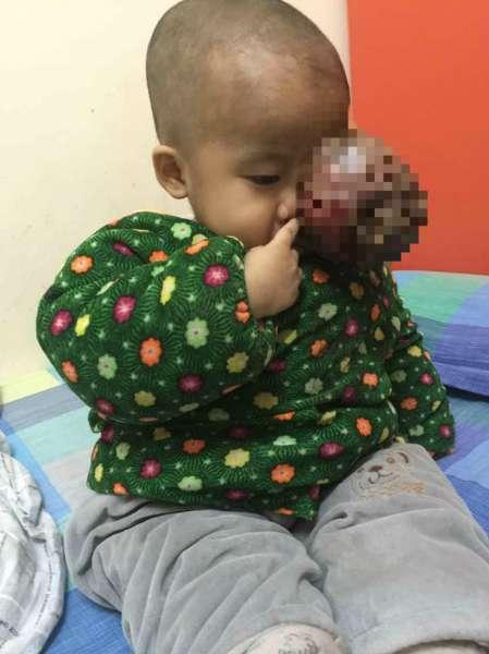 &ldquo;��ʱ�Һ������������ź���ȥ����ҽѧԺ�����ڶ�ҽԺ��飬���ҽ��˵���麱�����޴��������ƣ��������ǻؼ����ơ�&rdquo;������˵��