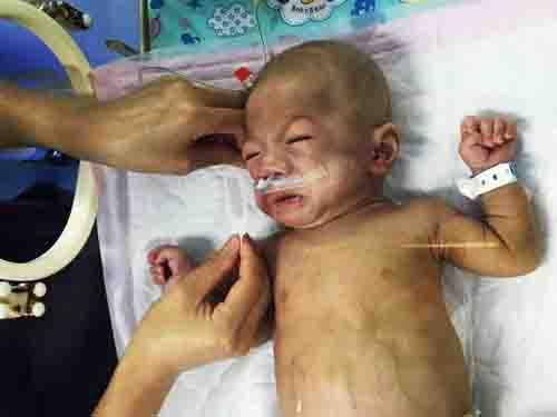 3��16�գ�ҽԺ֪ͨС���ӿ��Գ�Ժ�ˣ�ȫ�����ŵ������ڷ���һ��������̶̲���һ���µ�ʱ�䣬ȫ���˾�������һ������ô���������ӵ��˲�������֢���ϸ�ĸ��ͷ��������Ͱ��˺ܶ࣬�Ž����������ʹ�����ֻ�ܲ��ϵİ�ο�����ǣ�����һ����������ġ�