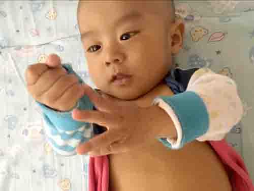 ������µ�ʱ�򣬻���һֱ���ˣ����Ǹ�ĸ������������������ҽԺ�������ҽ��һ�����ӵ�Ƥ����ô�ƣ�ֱ�Ӿͽ�����ȥ�����ж�ͯҽԺ���ڳ���������ؼ���ҽԺ����������Ǹ����ۺ������ٴ����ȥ���߼���ҽԺ�����εĸ�ĸ���������˹��ݶ�ͯҽԺ��������Ҳ�޷�ȷ�