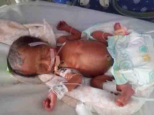 2015��9�£���ͬ���м���Ϊ��ĸ���и�һ�������Թ㶫ʡһ����ͨũ���ͥ���̲�ϼ�����Ÿ��е�һ˫����˳��������һ���Ŀڼ�򵥵������Ҹ�������������˫��̥�Ľ��ٲ�֪�Ƕ����˵����Σ�������������Ľ���ѣ�ȫ��������ϲ֮ʱ��һ����ʴ����˼��˶�����δ�������Ρ�