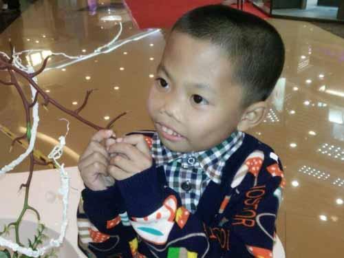 2007��3��12�գ�С�����ٴγ�����ɫ�԰ס����֡����յ������������Ѫ���ƺ�С���������˺�ת��ҽ��˵����Ĳ����е�����к�ƶѪ��֢״������Ϊ�����˳�Ѫ��顣3��18�գ����ڼ�ͥ��˵�Ǹ�ʹ������ӣ�����һ��С����ȷ��Ϊ����&beta;���к�ƶѪ��