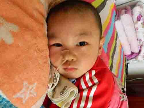 ҹ��1���ת����ͯҽԺ����ʱ����������������Σ�գ��ڼ��������Ժ˴Ź�����CT����Ƭ�������Ѫ��������û����ʲô���⣬���ӻ��ܳ��̣����졣7��6�����红��ͻȻ�鴤�����գ���־���壬ֱ��ת����֢�໤�ң�����֢ҽ��������һ���Ų�Σ֪ͨ�飬˵Ҫ��������׼��������������ʱ��û����