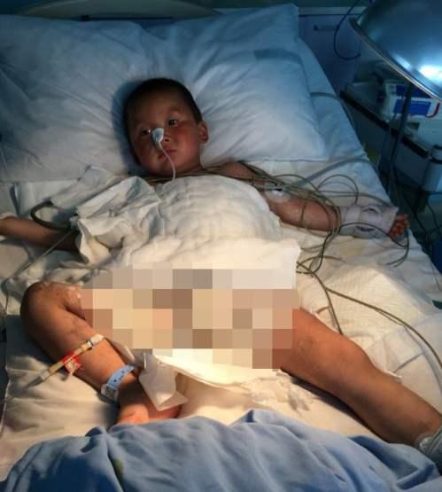 ���ھӵİ����£��ְֽ������͵��˵���ҽԺ�����������������ҽԺ����תԺ���ơ��������磬���±��͵�̫��ҽԺ��ҽ����ϣ�����ȫ�����������40%����Ҫ�Ǵ��ȡ��β���Χ�������ˡ������ڶ�ͯ��˵�����������20%���Ͼ��������ش����ˡ����ڲ����ϵ����£�����ͷ�����������嶼��ɴ�������š�