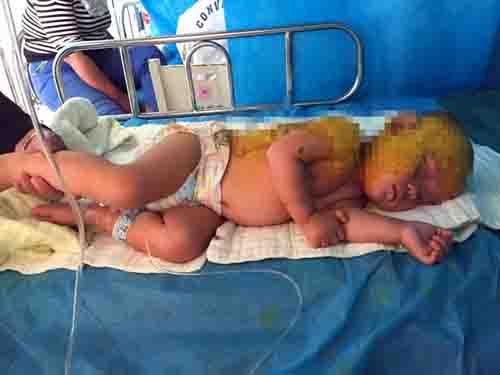  �ϵ����ڸ��공�Ѻ�����������ֻʣ��170��Ԫ������סԺѺ���Ҫ1��Ԫ��������ɵ���ۣ�����ֻ������Ժ���ȸ��������ơ��ڶ��죬���ǲŶ�ƴ���գ���ǿ����6000��Ԫ�����Ʒ��á�