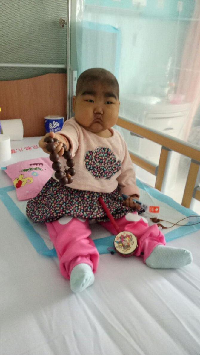 ��ֲ����Ҫ����40����Ϊ�ضȸ�Ⱦ���ý���ҩ���ƣ���������Ѫ��ά���Ѿ����˶�ʮ����ʮ���ֱ���������֣�����ֻҪ�����ܻ��ôҲ��취�������β���һ�ߵ�����Ǯ��һ�߸������������ͣ������˽�����ǰ���ϣ�ҽԺ��ֲ��Ҫ��һ�����¡�