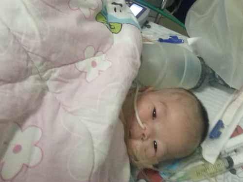 ת����϶�ͯҽԺ��������֢�໤�ң���9��18���������ʳ������������������ź�������ȫ����ICU�ȹ�������Σ���ڣ���10��5�ճ�Ժ�ؼҡ�����Ժ20�죬С����̳���Ǻ�̿��ԣ���ĸ�ٴδ���С�ൽ���϶�ͯҽԺ��ͨ����Ӱ֧���ܾ���飬����С����ʳ������������������Ҫ����2�β�©������