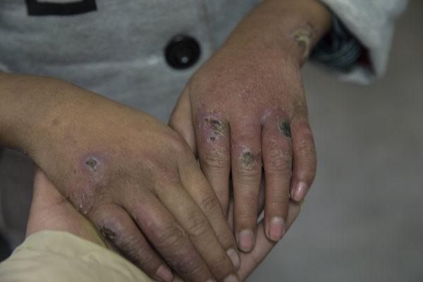 һ˫8���������֣������Ŀ㶵����ȡů��&ldquo;����&rdquo;���ֵ����˽�С��������������һ�����Сѧ��ѧ����С����ס��ɽ��������Ѿ����Ŷ���,�ְֳ�������򹤣�������һ���������ߺ����䣬С��ֻ�е������·�����Ϊ���������������붼�˲��ȡ���һ���ͻ���ۣ�һ�����������õ��˿ھͻ���Ѫ�� 