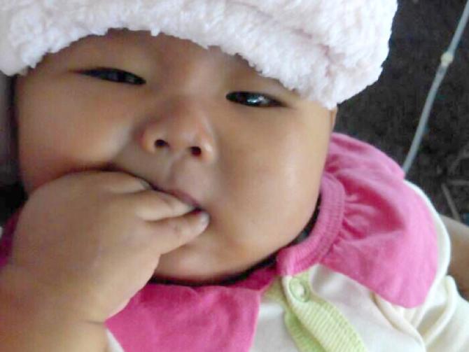 Сʫ���Ⱥ����ε��人�ж�ͯҽԺ���һֱ��ȡ�������Ʒ������ɺ��������Ѿ������ˣ�������û��˿���ĺ�ת��ȫ��Ƥ���ضȻ�Ⱦ����Ӳ����ˮ��Ƣ���״�˫���ܼ�ѹ���Ρ�С�����ɫ�����Ұ�ɫ���������ַ��շ��ȵ�֢״�� ҽ������������ֲ����������ĿǰΨһ�����Ʒ�����ʫ�������������θ�������