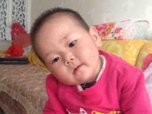 2014��10��30�գ����ĳ����ðְ��ޱȻ����������˷���4�����µĺ�����Ӧ�е�һЩ֫�嶯����������Ц�������������Ͽ�������Ա��˵Ķ��֣����ƺ�һ����֪���޷�ƾ���Լ�������ת��ͷ����ֻ��ת��������Ѱ�����Լ���Ҫ�����Ķ����������İְִ���������ʡ��ͯҽԺ�����˶�����δ����