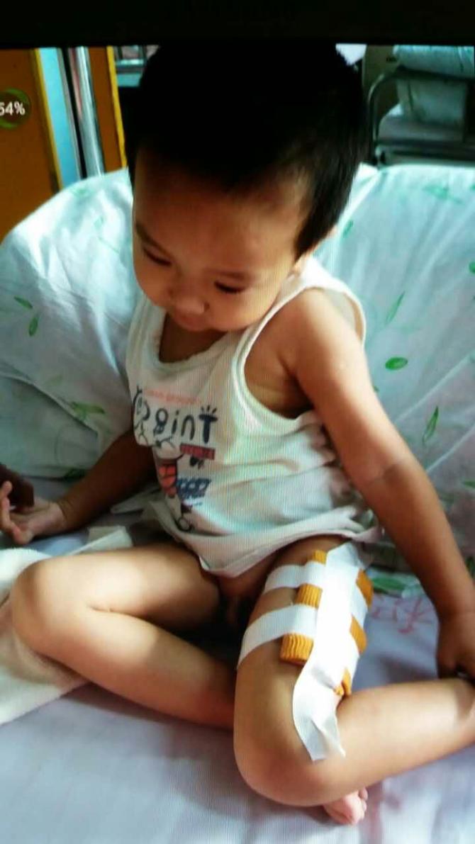 ��Ϊ���⻼�����������������֣�������һ���˽������ױ�������һ�δμ��ѵ�֧��֮���������ڿ�ʼ׼�������������ơ���ʮ��������Ʒѣ���������ծ̨������