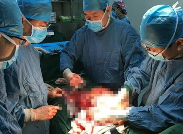 ��ɽҽԺ�޽�����ϸ�Ŀ���֮ǰ��CT���и��ֱ���󣬽�������׼������10��Ԫ�����ѡ������ĸ�ĸ�������ֻ��4��Ԫ������Ķ������������ѽ����ǿ�չ���������������11��Сʱ��������������������˵�������ܳɹ����Ѿ���2����֮��������г���