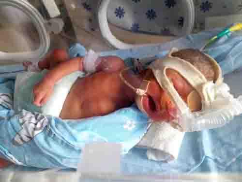 2016��4��13�գ��̲�ϼ���޶�����Ժ���̥������˫��̥��Ѫ�ۺ������ļ�������ˮ���࣬��ʱ��̥�����У����鵽���ݴ�ҽԺ���в�ǰ��ϡ�4��15���̲�ϼ�ڹ���סԺ��B�����ճ�����ҽ����֪̥ͨ��������Ѫ������������������̥������֪����һ���������ܻᱣ��ס���ü�����������׼����