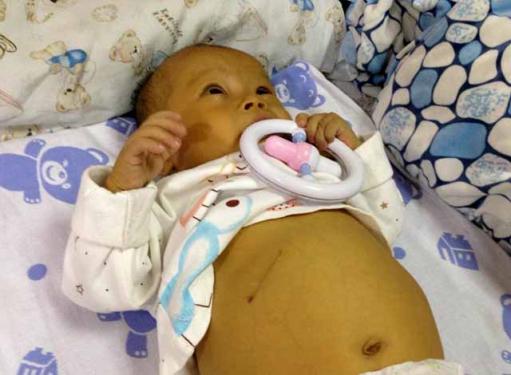 С���Գ����󣬾;�������ԭ��ؿ��֣����۰��컹�����϶�����˯��������ʱ��������������Ժ��Ԥ���룬��ʱҽ����˵�����е�ƣ���Ȼ������Ԥ���룬�����軹�ǲ����ģ���С�����������и��ױ���Ժ����ʱҽ���������𖕻ƻؼҿڷ���������ҩ�Ժ�ı������ǻơ�