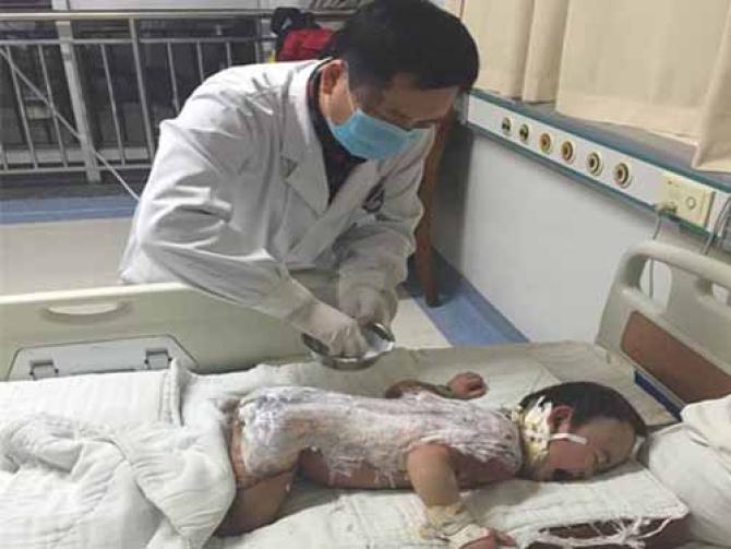 �����ݾ�����³ľ����ҽԺ��֢�໤������ҽ����Ա�����˵����ɽ��о��Σ���ҽԺ�������ο��������˱���ܣ����ɸ�Ⱦ��ŧ���أ����������60%���ң������ش������������ˣ����ӳ��˱�����˫�Ⱥ͸첲�Ȳ�λ�����Ⱦ���أ������е͵���Ѫ֢���ض�ƶѪ��֢״����ʱ��������Σ�ա�