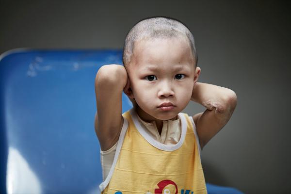 2015��1��27�յ����ϣ������ʧȥ��Ц�����������������ԣ��С��ͥ�����ֱ���Ǹ������ԵĴ�����¹����˳̶ȴ�66%����ֳ��Ҳ�ܵ����������ˡ�һ���ɰ�˧���������С�к��������������˲����ϡ�